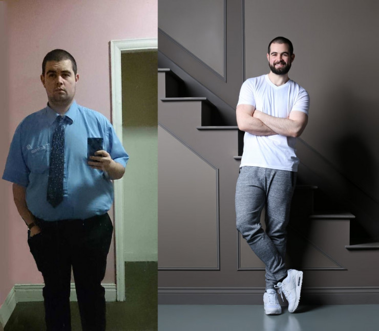 До и после — Дмитрий, 34 года